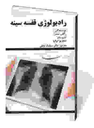 رادیولوژی قفسه سینه